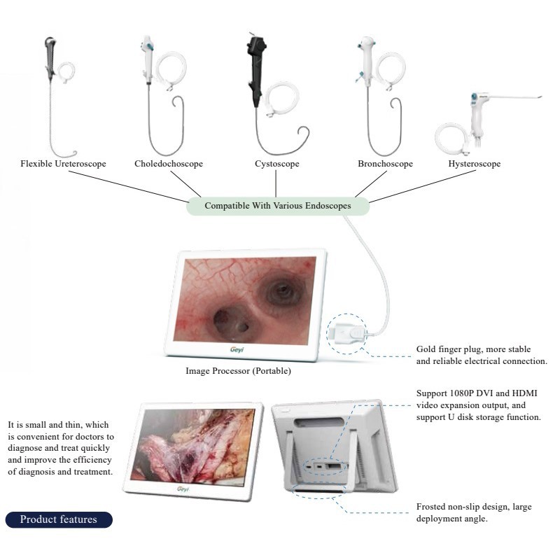 Medical Endoscope Monitor Medical Endoscope Monitor